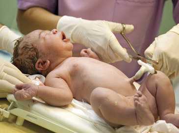 霉菌性阴道炎的预防攻略：五个日常习惯让你远离感染